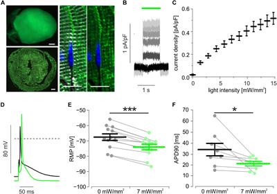 Optogenetic Hyperpolarization of Cardiomyocytes Terminates Ventricular Arrhythmia